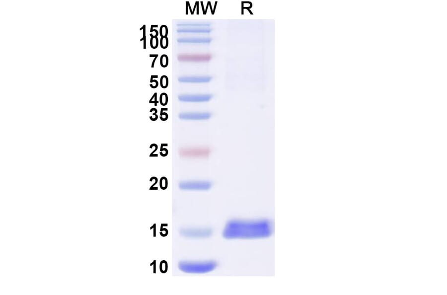 SDS-PAGE - Anti-RECQL5 Nanobody [SAA1129] (A337736) - Antibodies.com