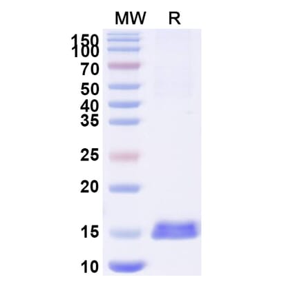 SDS-PAGE - Anti-RECQL5 Nanobody [SAA1129] (A337736) - Antibodies.com