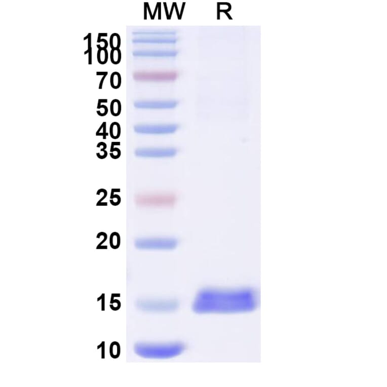 SDS-PAGE - Anti-RECQL5 Nanobody [SAA1129] (A337736) - Antibodies.com