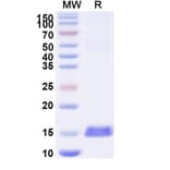 SDS-PAGE - Anti-RECQL5 Nanobody [SAA1129] (A337736) - Antibodies.com