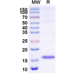SDS-PAGE - Anti-RECQL5 Nanobody [SAA1130] (A337737) - Antibodies.com