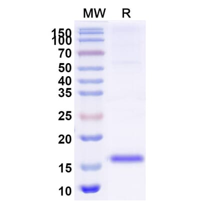 SDS-PAGE - Anti-RECQL5 Nanobody [SAA1130] (A337737) - Antibodies.com