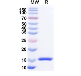 SDS-PAGE - Anti-RECQL5 Nanobody [SAA1131] (A337738) - Antibodies.com