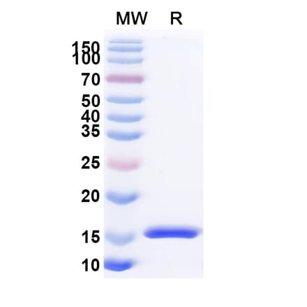 SDS-PAGE - Anti-RECQL5 Nanobody [SAA1131] (A337738) - Antibodies.com