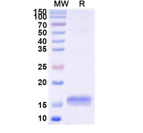 SDS-PAGE - Anti-RECQL5 Nanobody [SAA1132] (A337739) - Antibodies.com