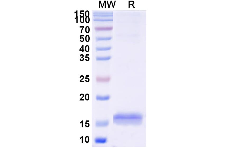 SDS-PAGE - Anti-RECQL5 Nanobody [SAA1132] (A337739) - Antibodies.com