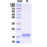 SDS-PAGE - Anti-RECQL5 Nanobody [SAA1132] (A337739) - Antibodies.com