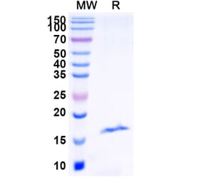 SDS-PAGE - Anti-RECQL5 Nanobody [SAA1133] (A337740) - Antibodies.com