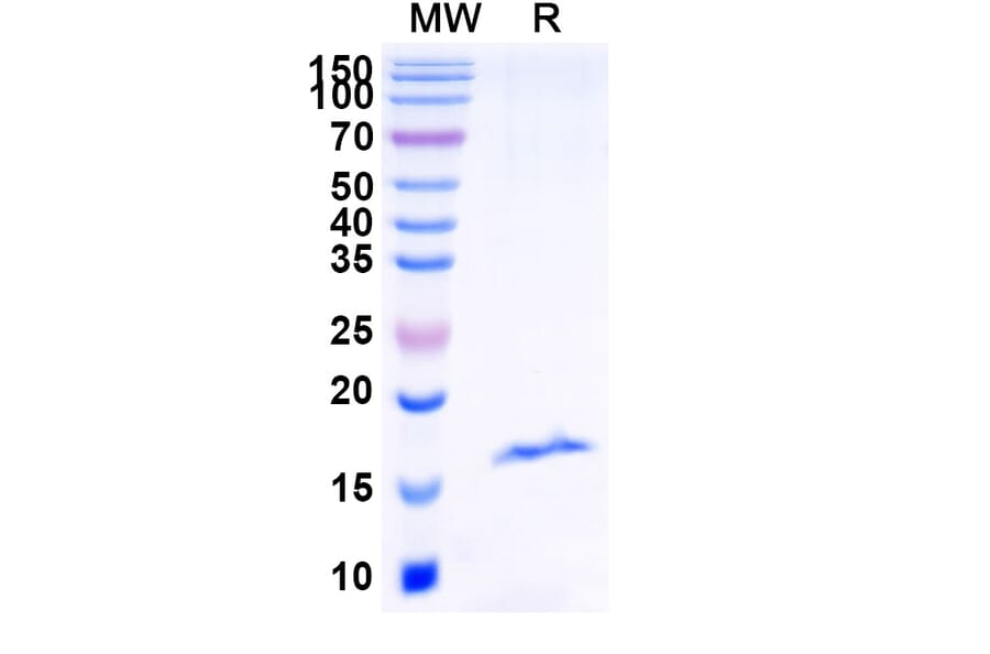SDS-PAGE - Anti-RECQL5 Nanobody [SAA1133] (A337740) - Antibodies.com