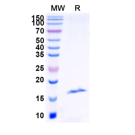 SDS-PAGE - Anti-RECQL5 Nanobody [SAA1133] (A337740) - Antibodies.com