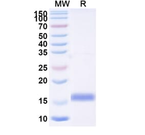 SDS-PAGE - Anti-RECQL5 Nanobody [SAA1134] (A337741) - Antibodies.com