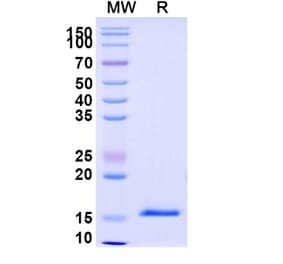SDS-PAGE - Anti-DKK1 Nanobody [SAA1268] (A337742) - Antibodies.com
