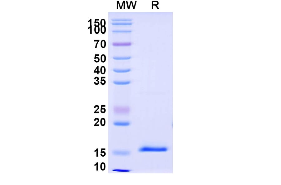 SDS-PAGE - Anti-DKK1 Nanobody [SAA1268] (A337742) - Antibodies.com