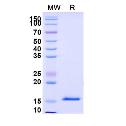 SDS-PAGE - Anti-DKK1 Nanobody [SAA1268] (A337742) - Antibodies.com