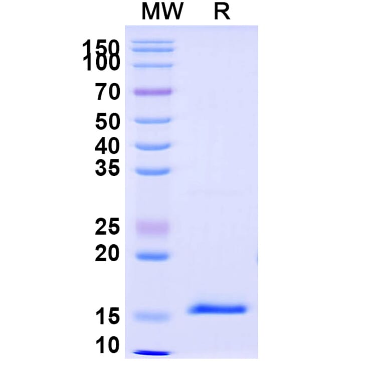 SDS-PAGE - Anti-DKK1 Nanobody [SAA1268] (A337742) - Antibodies.com