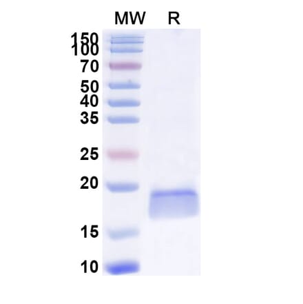 SDS-PAGE - Anti-SOD1 Nanobody [SAA1203] (A337743) - Antibodies.com