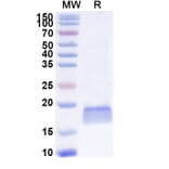 SDS-PAGE - Anti-SOD1 Nanobody [SAA1203] (A337743) - Antibodies.com