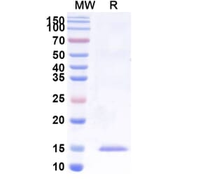 SDS-PAGE - Anti-uPA Nanobody [SAA1008] (A337749) - Antibodies.com