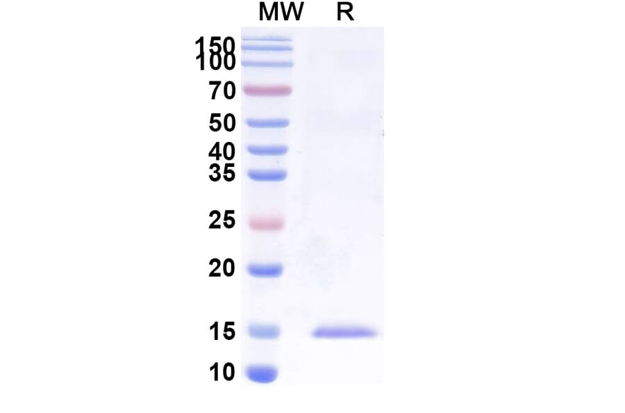 SDS-PAGE - Anti-uPA Nanobody [SAA1008] (A337749) - Antibodies.com