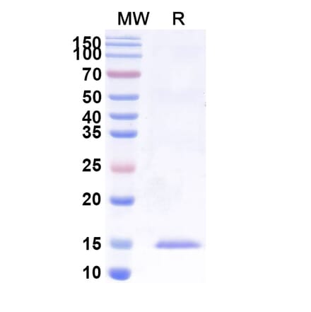 SDS-PAGE - Anti-uPA Nanobody [SAA1008] (A337749) - Antibodies.com