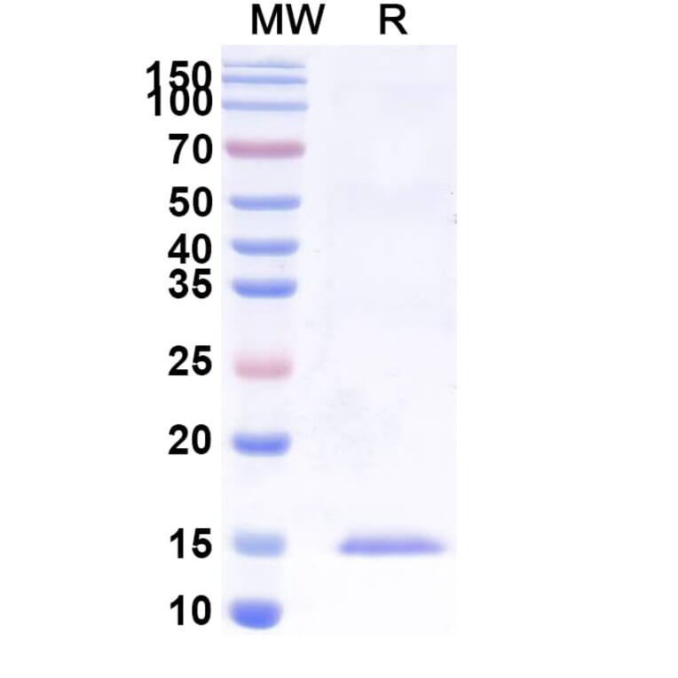 SDS-PAGE - Anti-uPA Nanobody [SAA1008] (A337749) - Antibodies.com