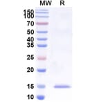 SDS-PAGE - Anti-uPA Nanobody [SAA1008] (A337749) - Antibodies.com