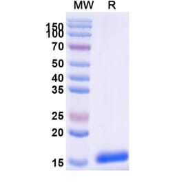 SDS-PAGE - Anti-C3 Nanobody [SAA0981] (A337752) - Antibodies.com