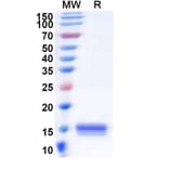 SDS-PAGE - Anti-C5 Nanobody [SAA1365] (A337753) - Antibodies.com