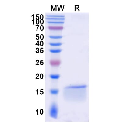 SDS-PAGE - Anti-c-Fos Nanobody [SAA1335] (A337754) - Antibodies.com