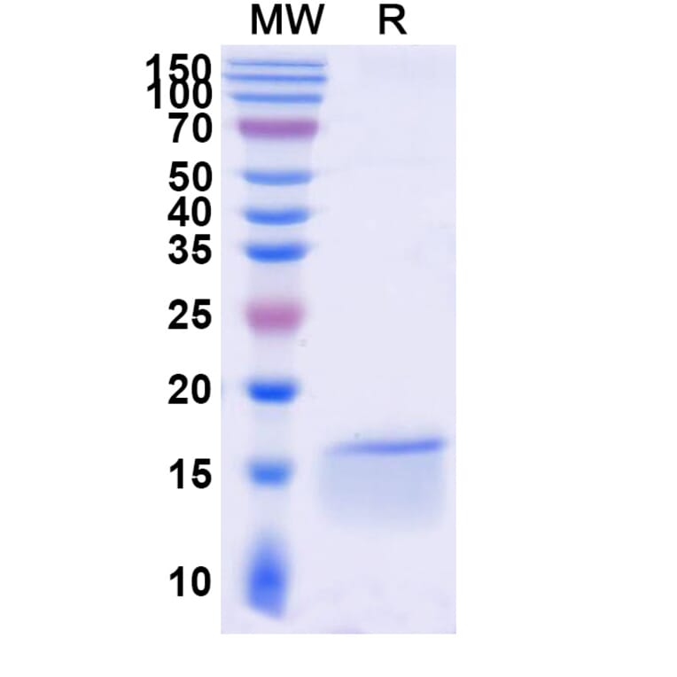 SDS-PAGE - Anti-c-Fos Nanobody [SAA1335] (A337754) - Antibodies.com