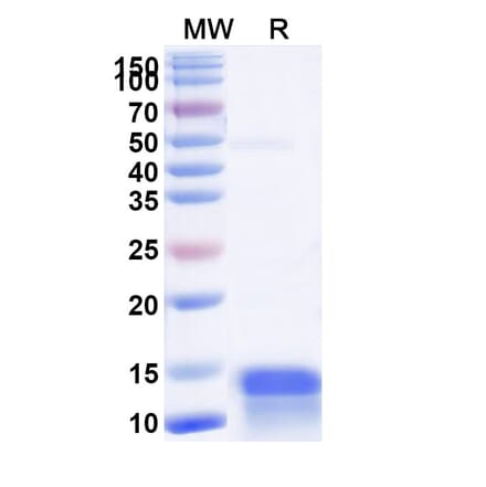 SDS-PAGE - Anti-Calcitonin Nanobody [SAA1243] (A337756) - Antibodies.com