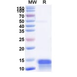 SDS-PAGE - Anti-Calcitonin Nanobody [SAA1243] (A337756) - Antibodies.com
