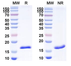 SDS-PAGE - Anti-Thyroglobulin Nanobody [SAA1339] (A337757) - Antibodies.com