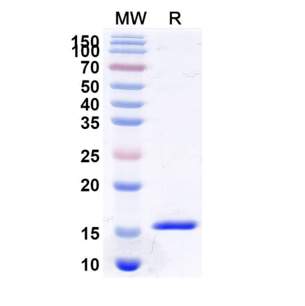 SDS-PAGE - Anti-Parathyroid Hormone Nanobody [SAA1261] (A337758) - Antibodies.com