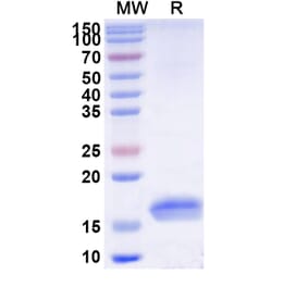 SDS-PAGE - Anti-TNF alpha Nanobody [SAA1201] (A337761) - Antibodies.com