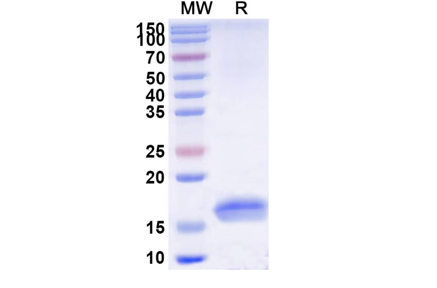 SDS-PAGE - Anti-TNF alpha Nanobody [SAA1201] (A337761) - Antibodies.com