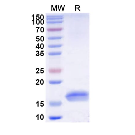 SDS-PAGE - Anti-TNF alpha Nanobody [SAA1201] (A337761) - Antibodies.com