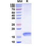 SDS-PAGE - Anti-TNF alpha Nanobody [SAA1201] (A337761) - Antibodies.com
