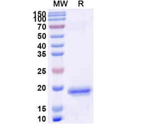 SDS-PAGE - Anti-PIGR Nanobody [SAA1311] (A337764) - Antibodies.com