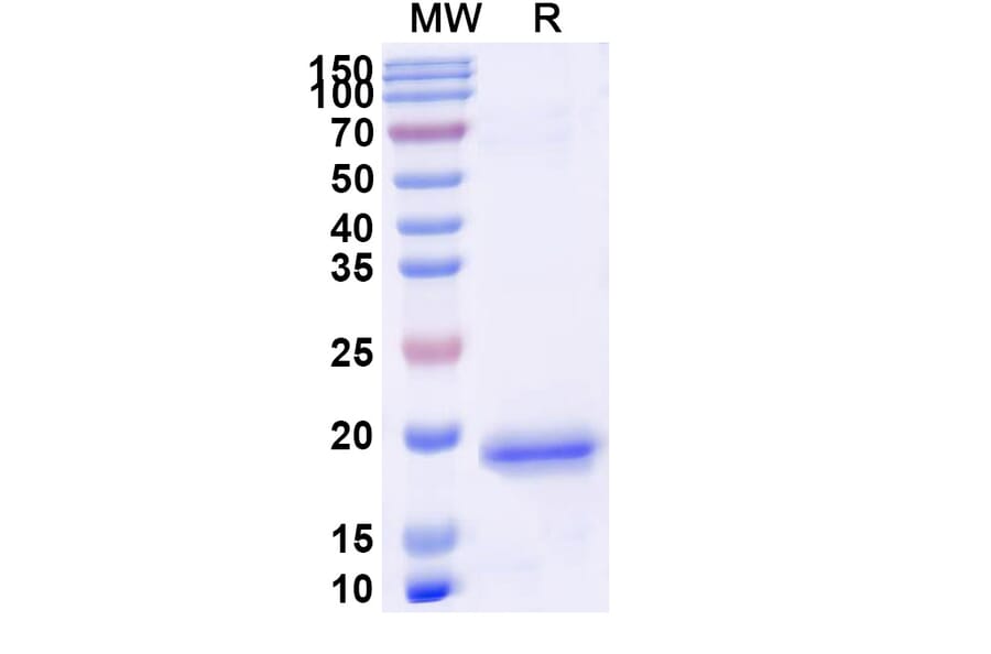 SDS-PAGE - Anti-PIGR Nanobody [SAA1311] (A337764) - Antibodies.com