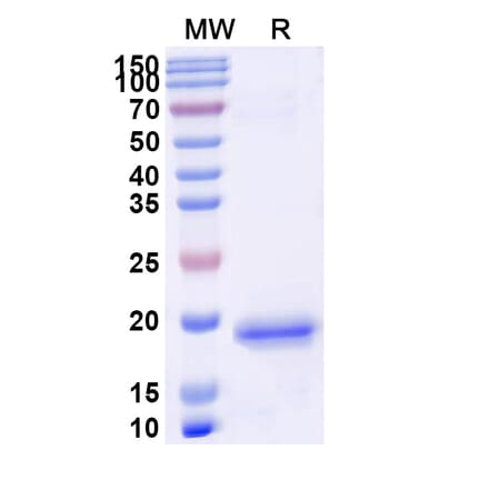 SDS-PAGE - Anti-PIGR Nanobody [SAA1311] (A337764) - Antibodies.com