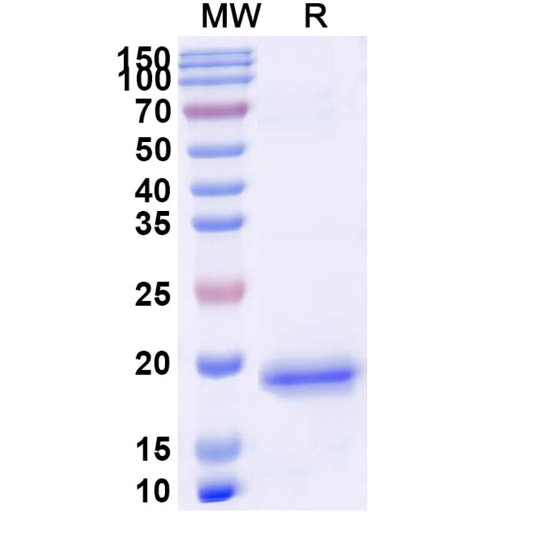 SDS-PAGE - Anti-PIGR Nanobody [SAA1311] (A337764) - Antibodies.com