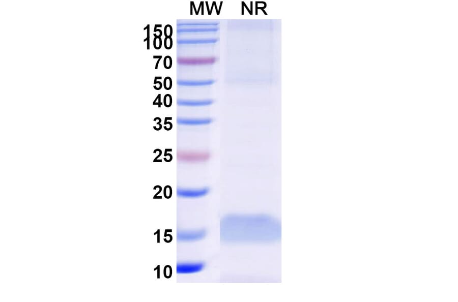 SDS-PAGE - Anti-C Reactive Protein Nanobody [SAA1358] (A337767) - Antibodies.com
