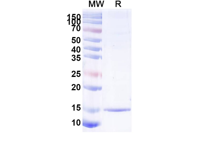 SDS-PAGE - Anti-Albumin Nanobody [SAA1019] (A337768) - Antibodies.com