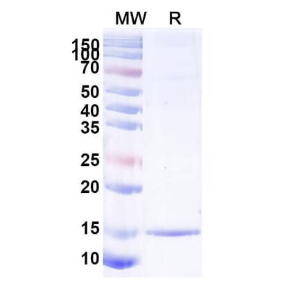 SDS-PAGE - Anti-Albumin Nanobody [SAA1019] (A337768) - Antibodies.com