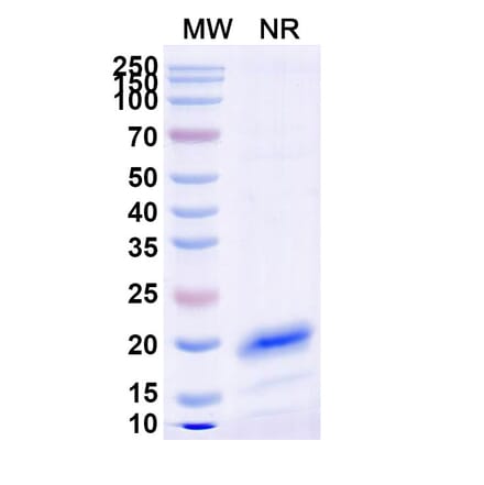 SDS-PAGE - Anti-Transferrin Receptor Nanobody [SAA1205] (A337770) - Antibodies.com