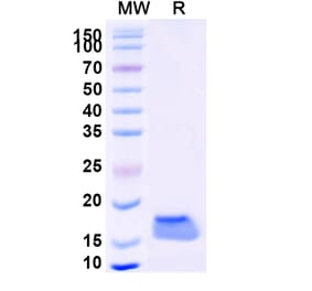 SDS-PAGE - Anti-Catalase Nanobody [SAA1202] (A337771) - Antibodies.com