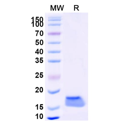 SDS-PAGE - Anti-Catalase Nanobody [SAA1202] (A337771) - Antibodies.com