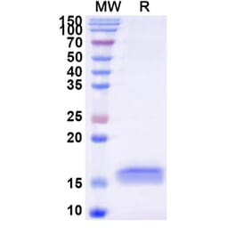 SDS-PAGE - Anti-PrP Nanobody [SAA0883] (A337772) - Antibodies.com