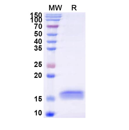 SDS-PAGE - Anti-PrP Nanobody [SAA0883] (A337772) - Antibodies.com